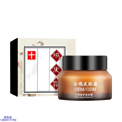 西青区_去鸡皮肤毛刺毛角周滋润修复保湿身体霜